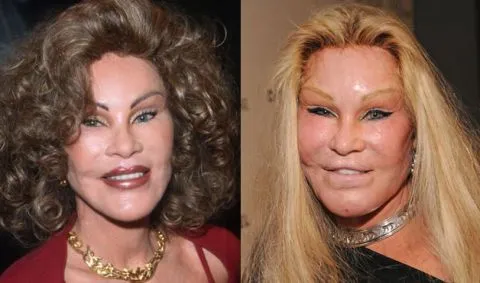 Jocelyn Wildenstein